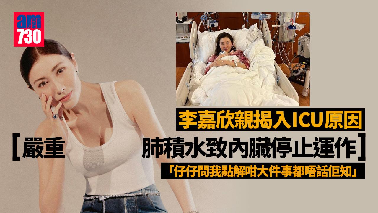 李嘉欣親揭入ICU原因 嚴重肺積水致內臟停止運作