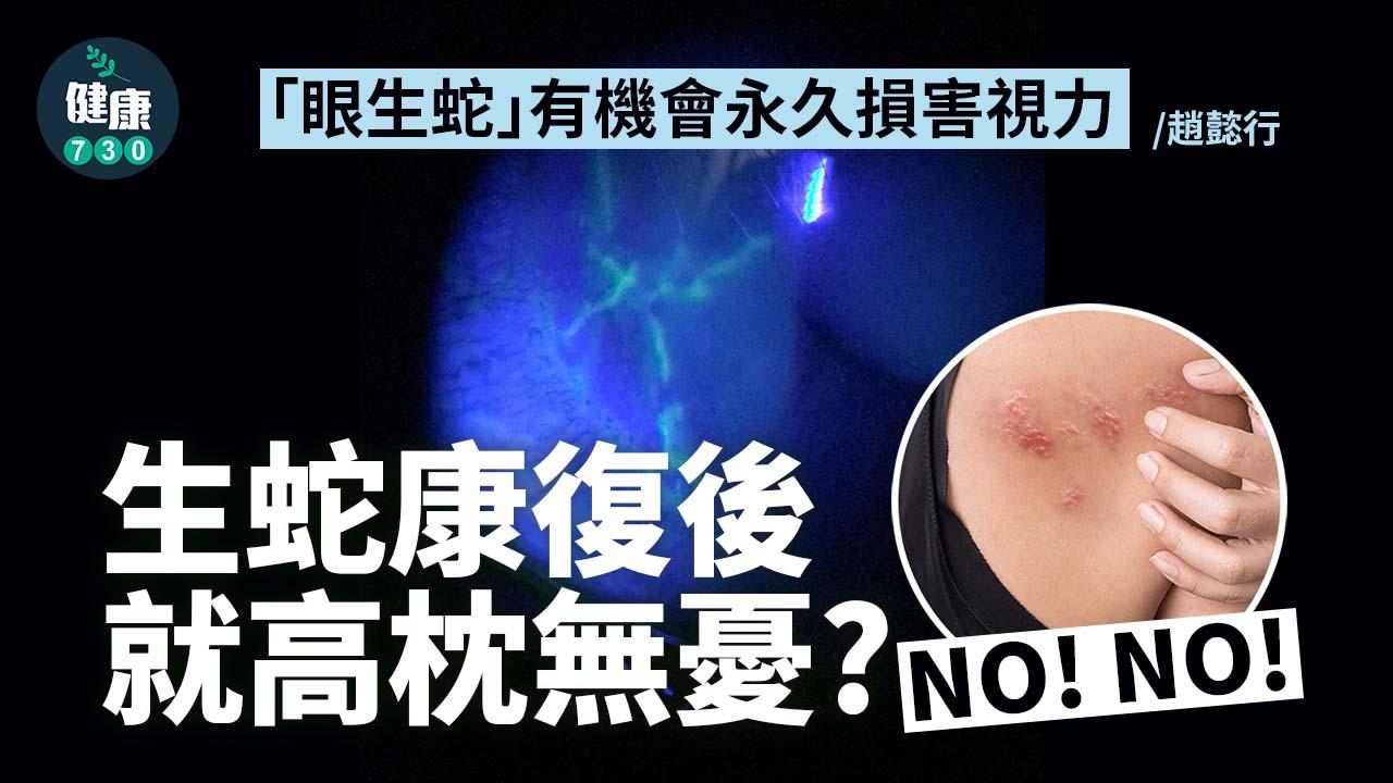 生蛇生上眼：「眼生蛇」有機會永久損害視力