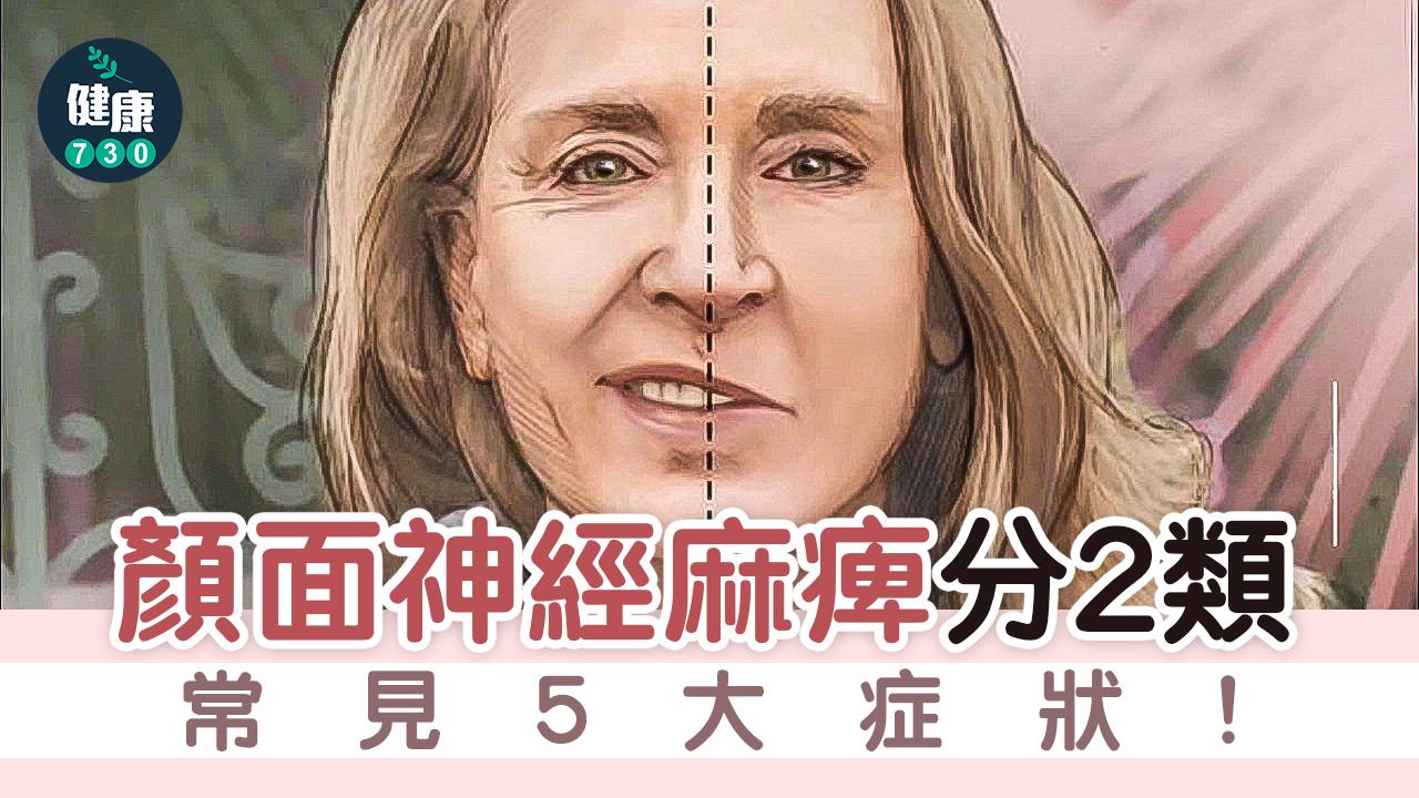 眼歪嘴斜小心顏面神經麻痺！中醫輔助治療恢復快