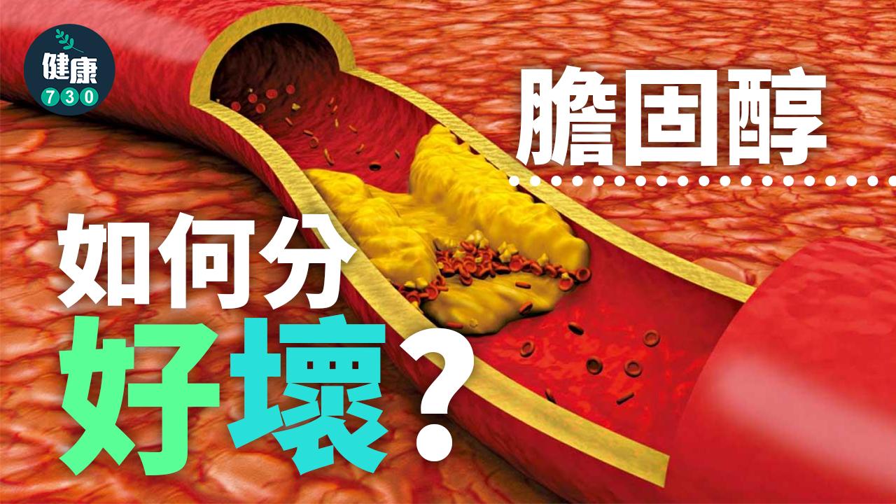 膽固醇如何分好壞？