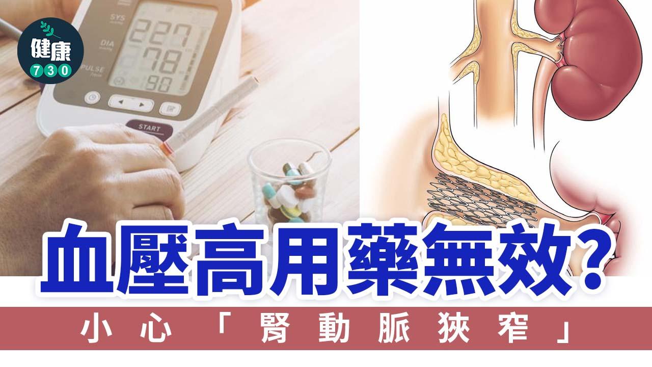 血壓高用藥無效？小心「腎動脈狹窄」