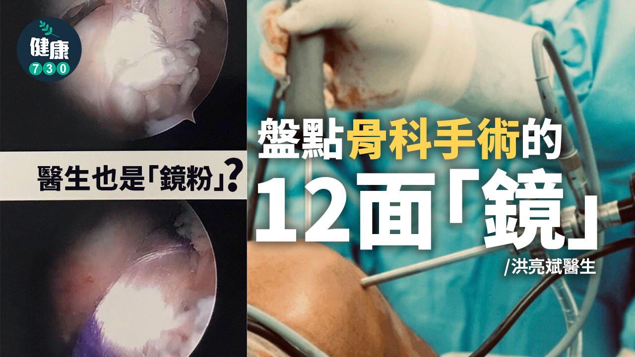 醫生也是「鏡粉」？盤點骨科手術的12面「鏡」
