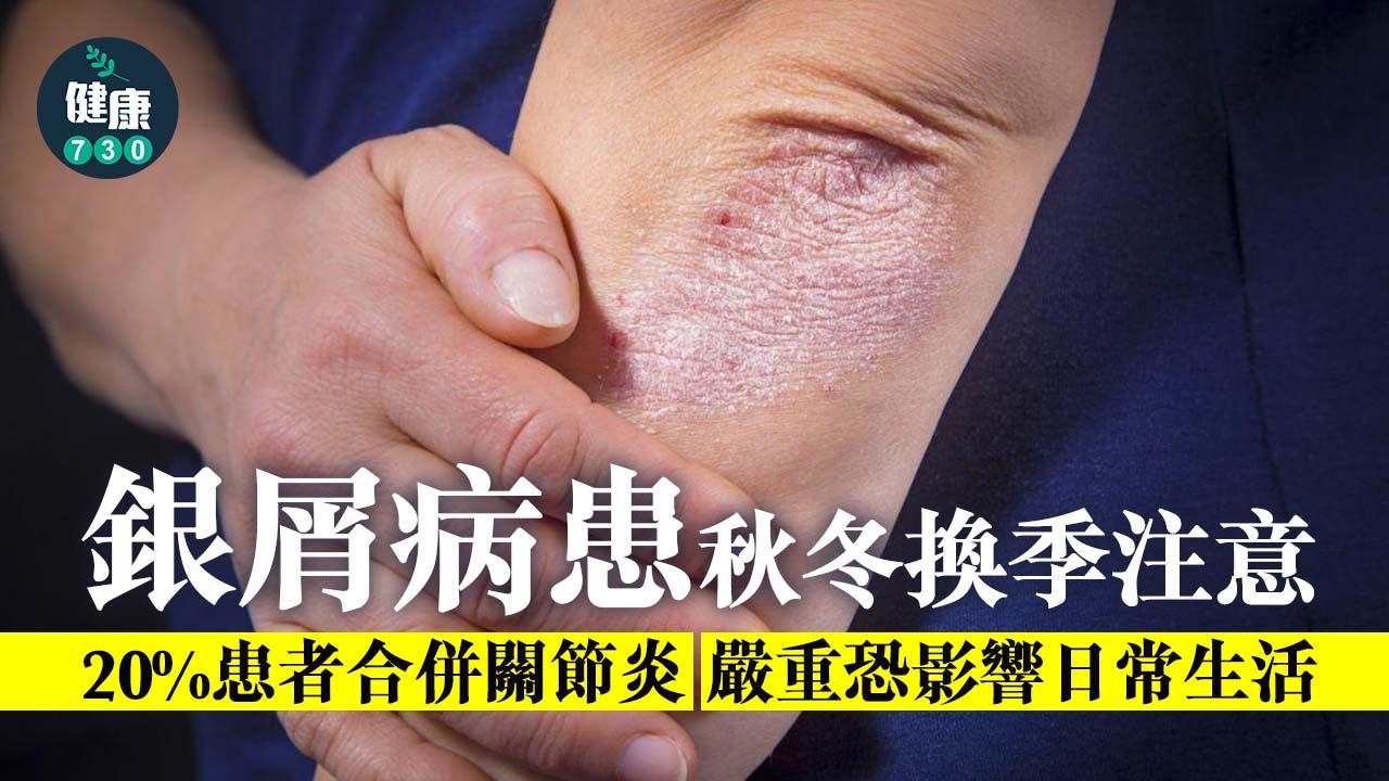 銀屑病患秋冬換季注意 良好快速控制好重要