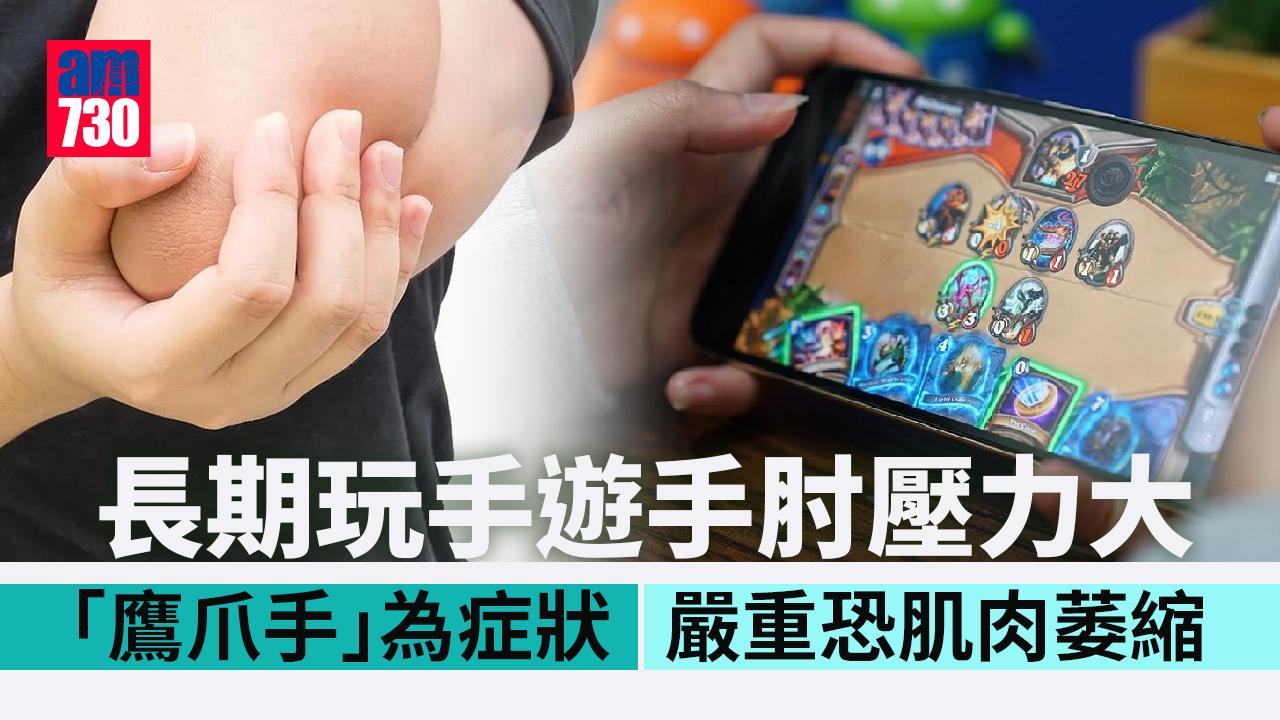 長期玩手遊小心尺神經壓迫 無名指尾指伸唔直