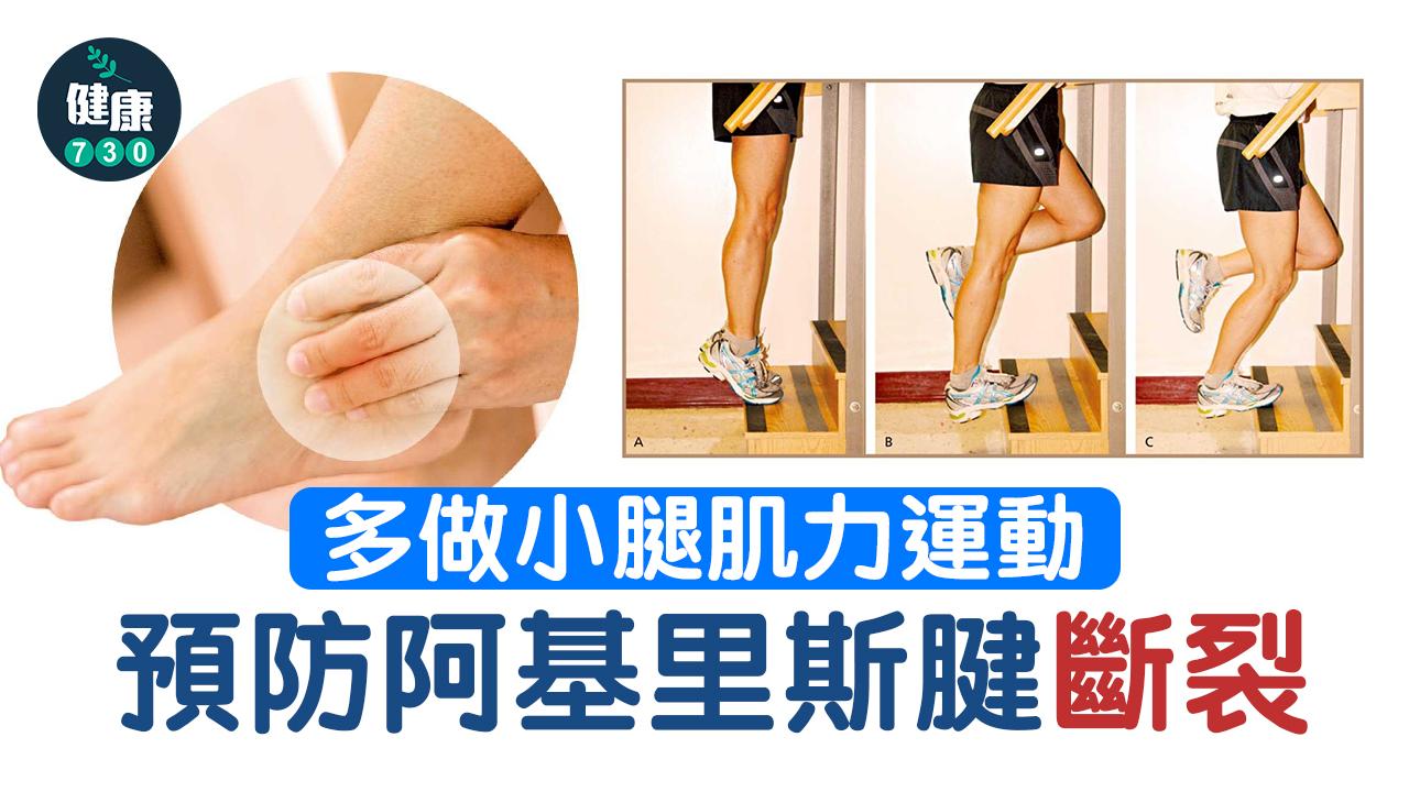 阿基里斯腱斷裂 約半年可康復