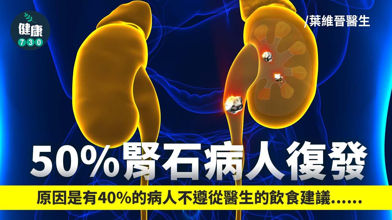 50%腎石病人復發