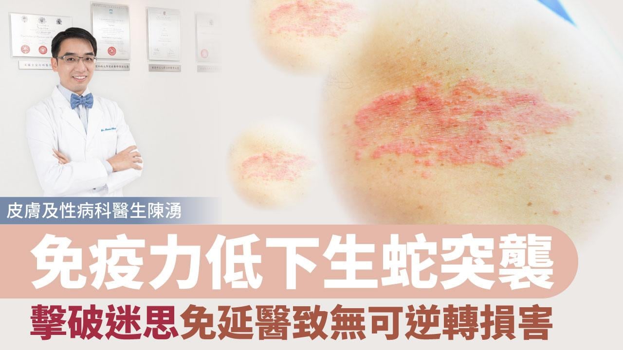 生蛇 | 免疫力低下生蛇突襲 擊破迷思免延醫致無可逆轉損害 Primary tabs View Edit(active tab) Revisions