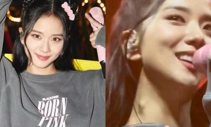 BLACKPINK Jisoo頸部現腫塊 粉絲：好驚嚇