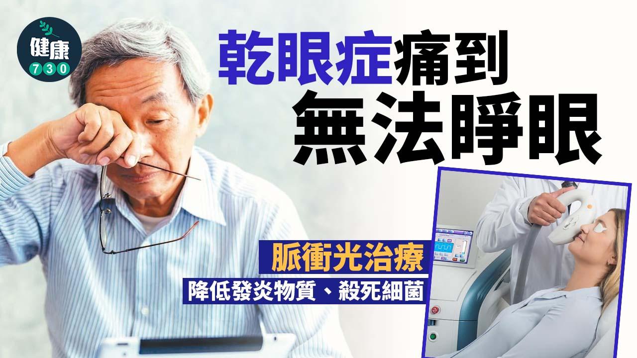 乾眼症痛到擘唔開眼 脈衝光或有幫助
