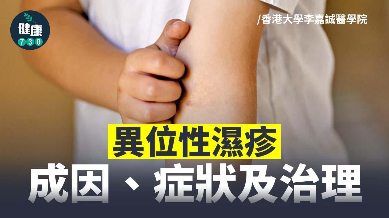異位性濕疹：成因、症狀及治理