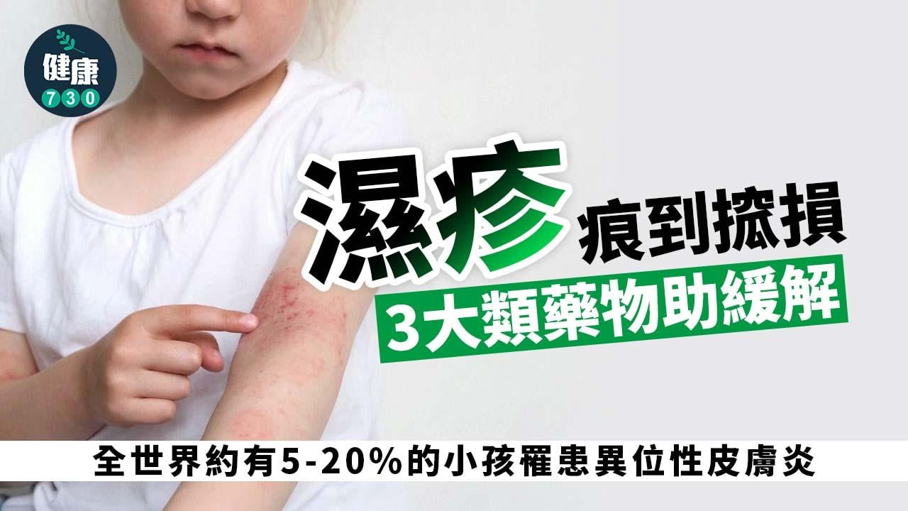 異位性皮膚炎痕到搲損 3大類藥物助緩解