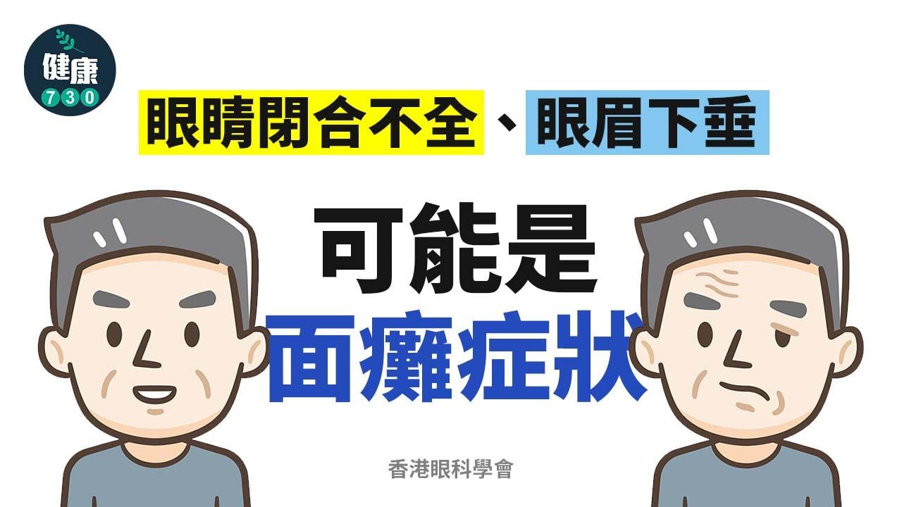 眼睛閉合不全、眼眉下垂 可能是面癱症狀 分