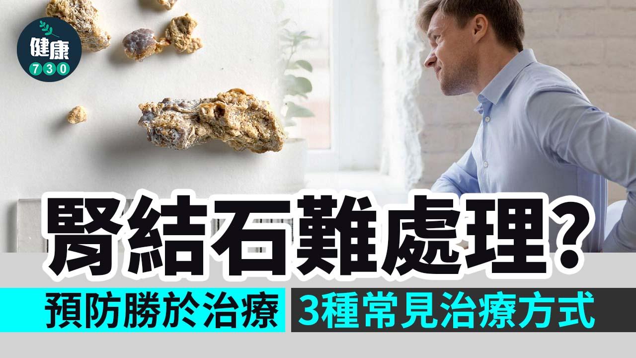腎結石難處理？軟式輸尿管鏡終結頑石