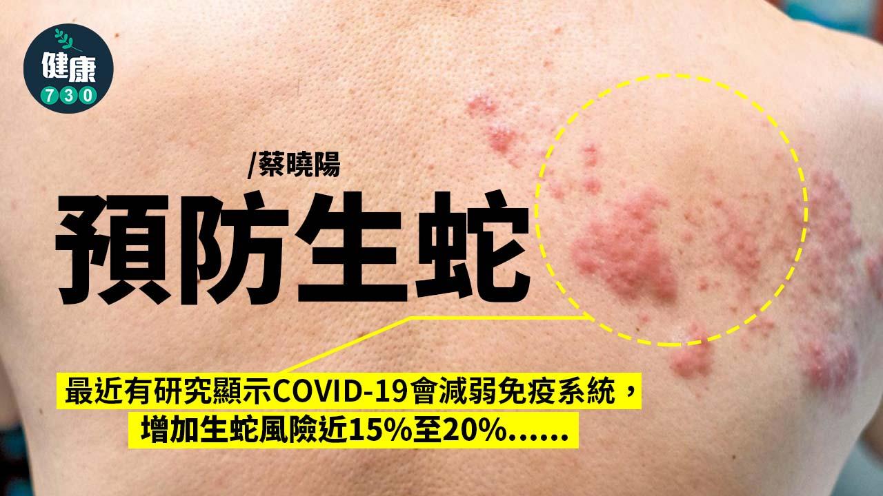 預防生蛇