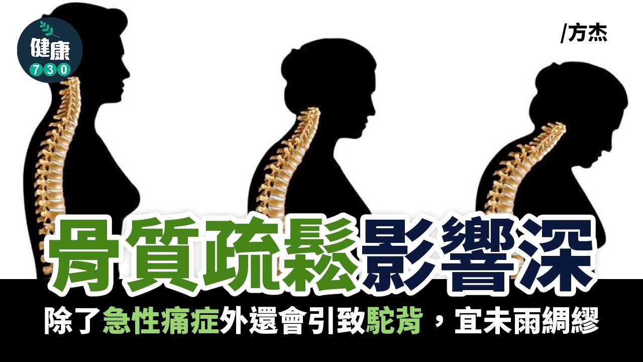 骨質疏鬆影響深 宜未雨綢繆