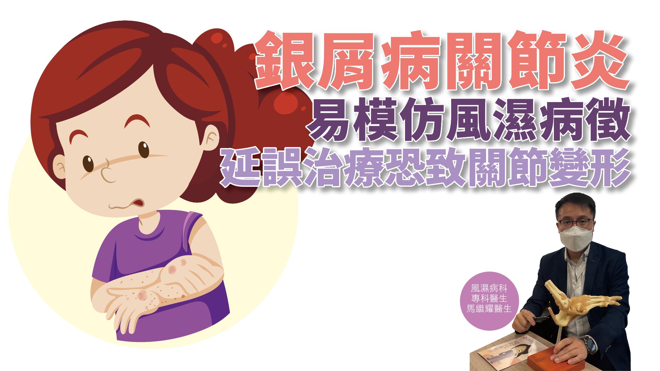 【健康解碼】銀屑病關節炎 易模仿風濕病徵 延誤治療恐致關節變形