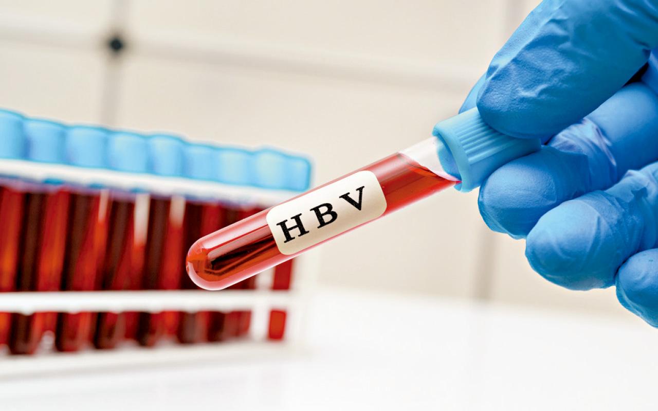 基層醫療中乙型肝炎及慢性乙型肝炎的普遍篩查和管理