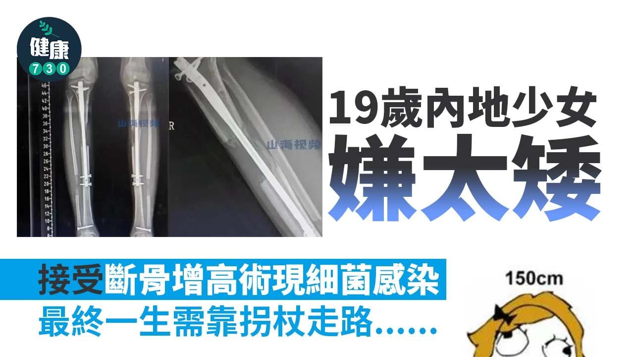  19歲內地少女嫌太矮 接受斷骨增高術現細菌感染 結局令人流淚
