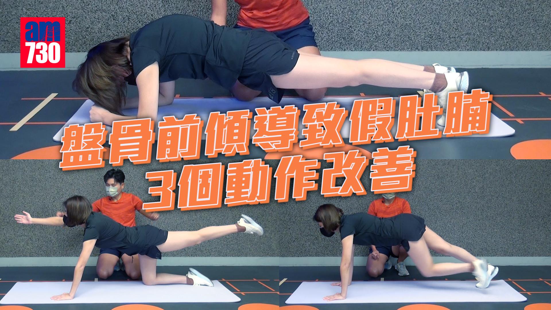 盤骨前傾導致假肚腩 3個動作改善