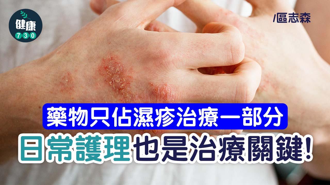 濕疹人士 認清治療終極目標