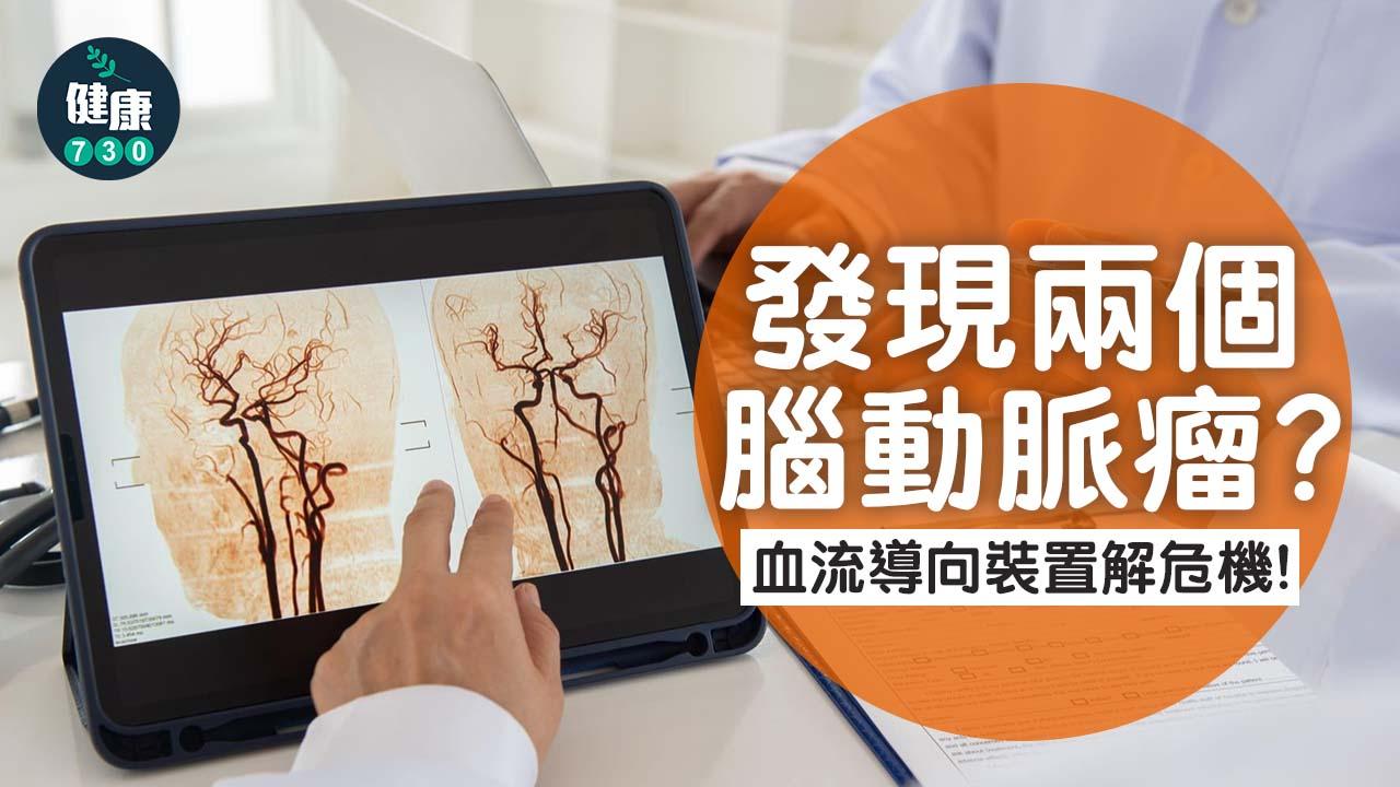 發現兩個腦動脈瘤？血流導向裝置解危機！
