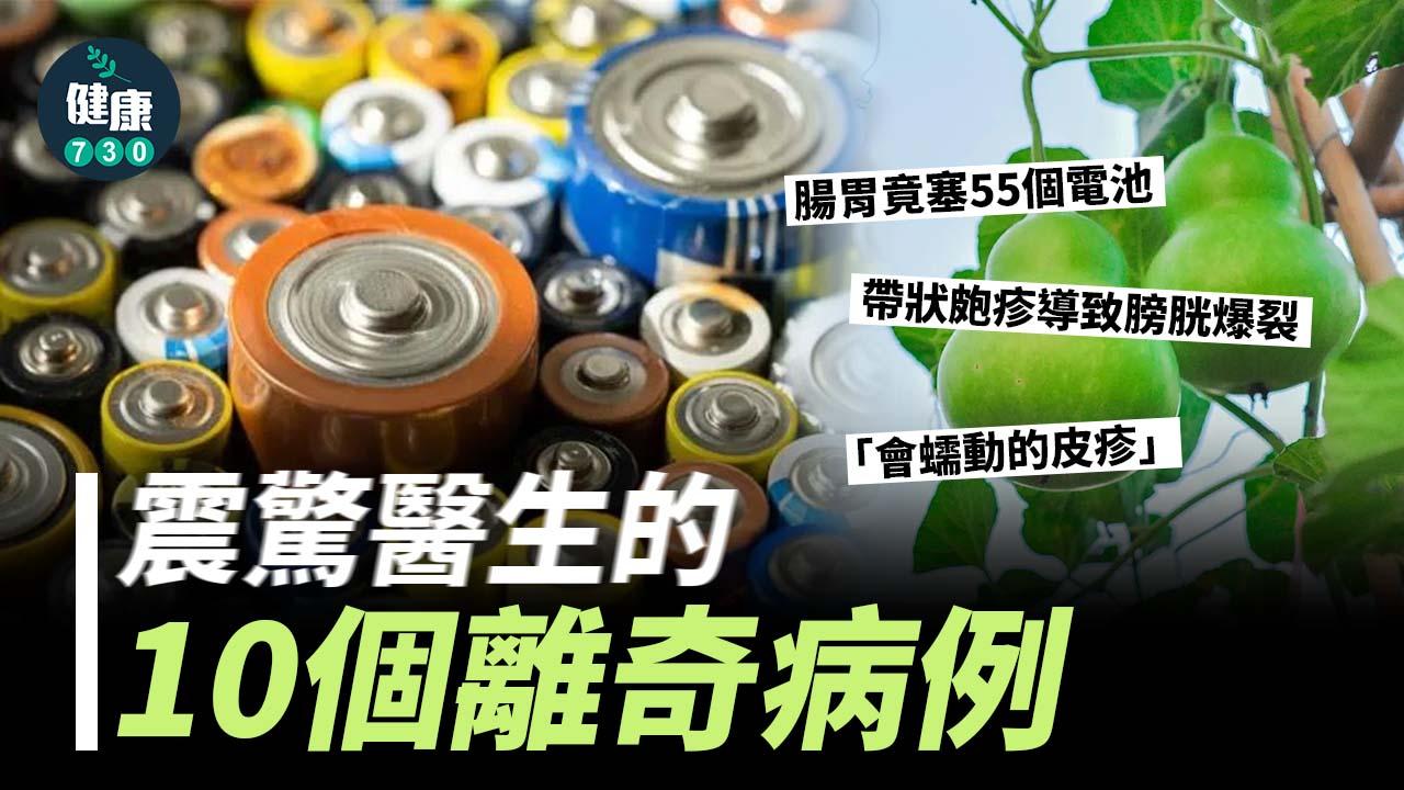皮疹會蠕動、腸胃塞55個電池！震驚醫生的10個離奇病例