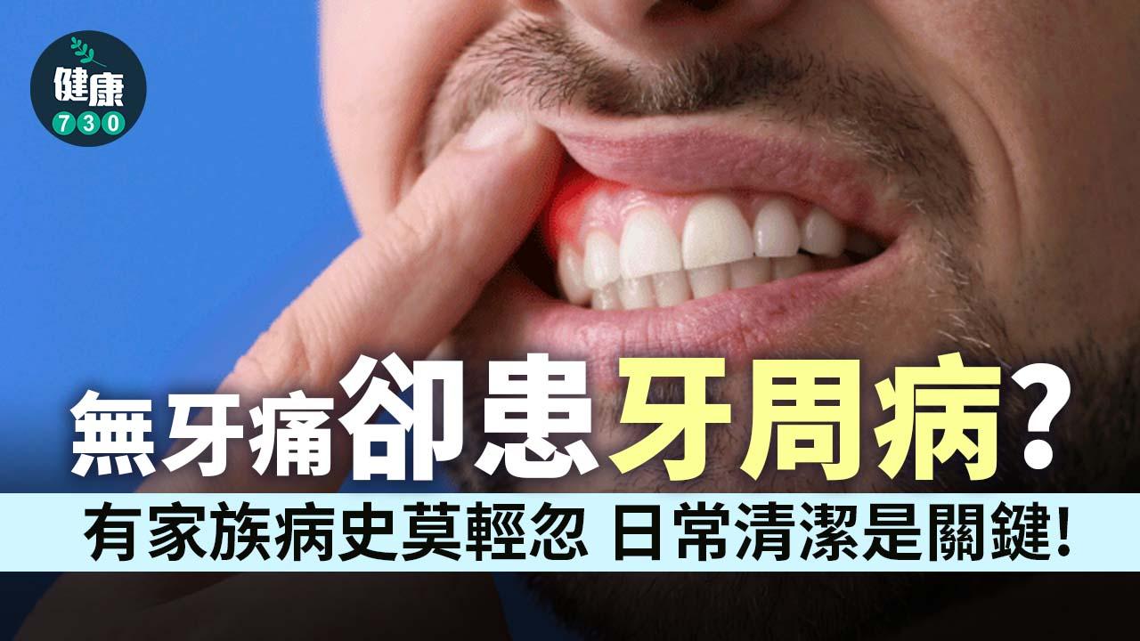 沒有牙痛卻患牙周病？醫直指「關鍵原因」：小心遺傳