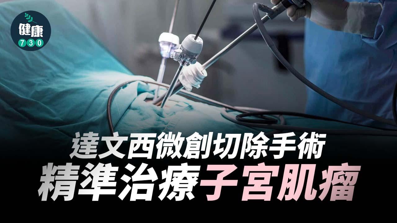 達文西微創切除手術 精準治療子宮肌瘤