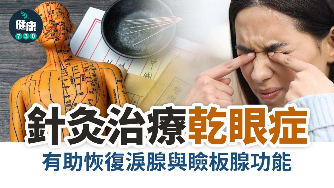 針灸治療乾眼症 有助恢復淚腺與瞼板腺功能