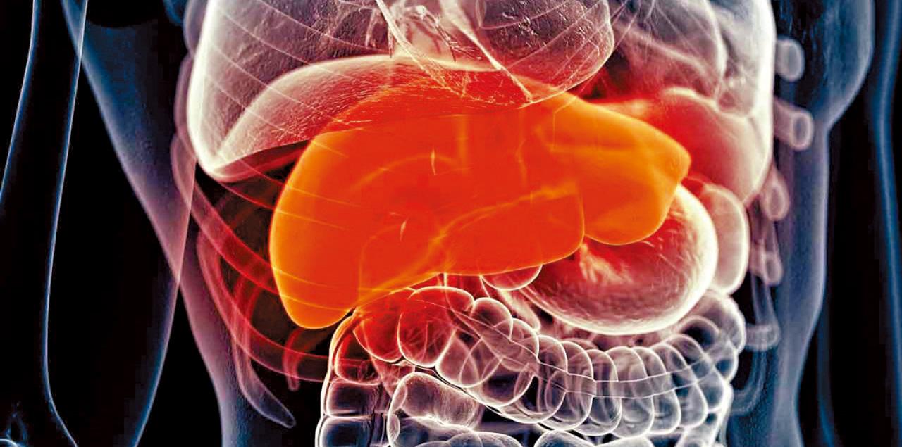 改善非酒精性脂肪肝的營養比例