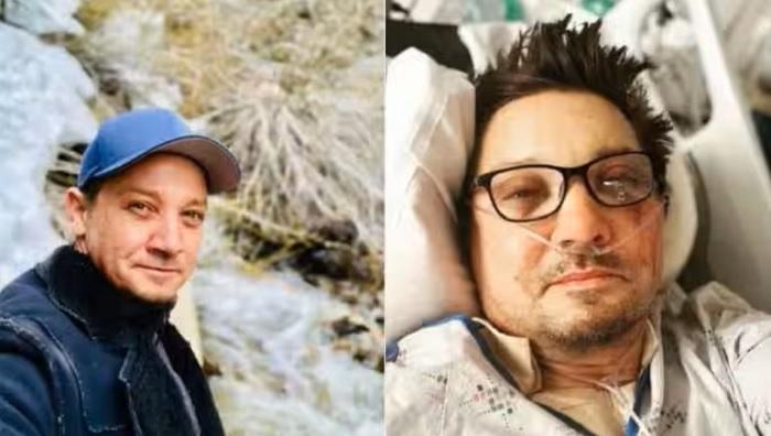 「鷹眼」謝洛美維納恐怖意外後漸愈 需時克服心理陰影