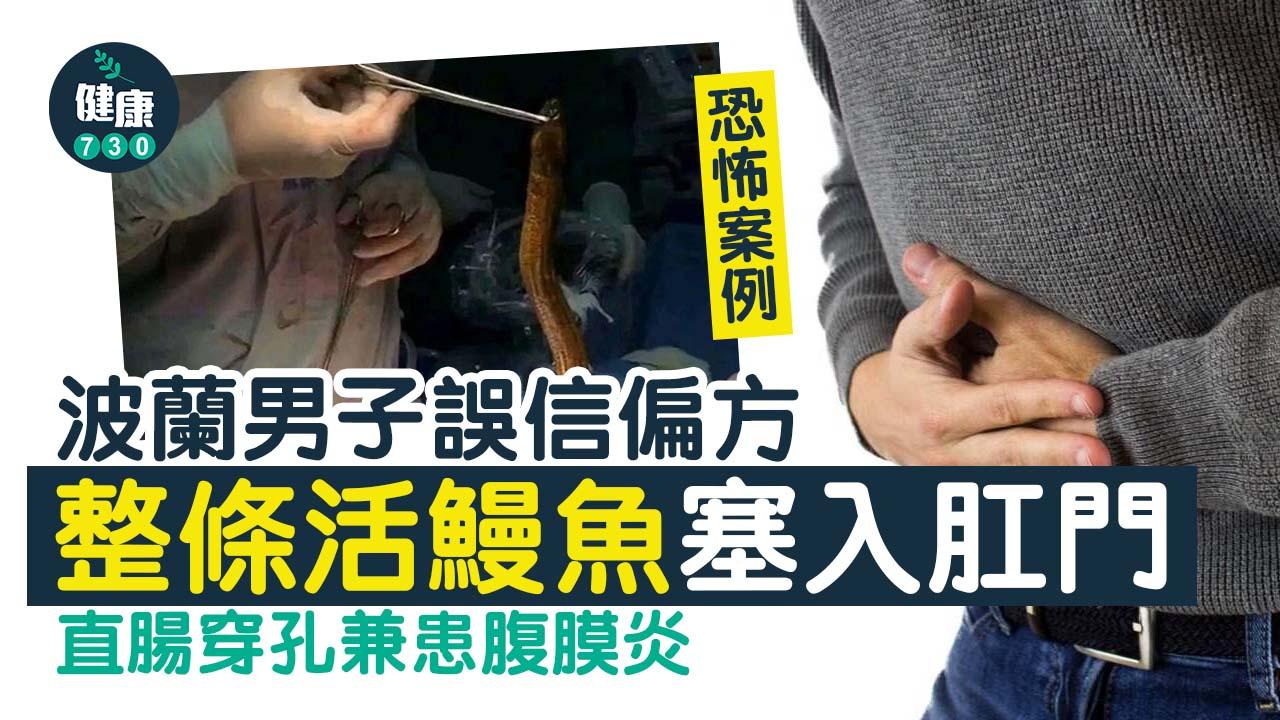 便秘｜波蘭男子誤信偏方 活鰻魚塞肛門致直腸穿孔兼患腹膜炎