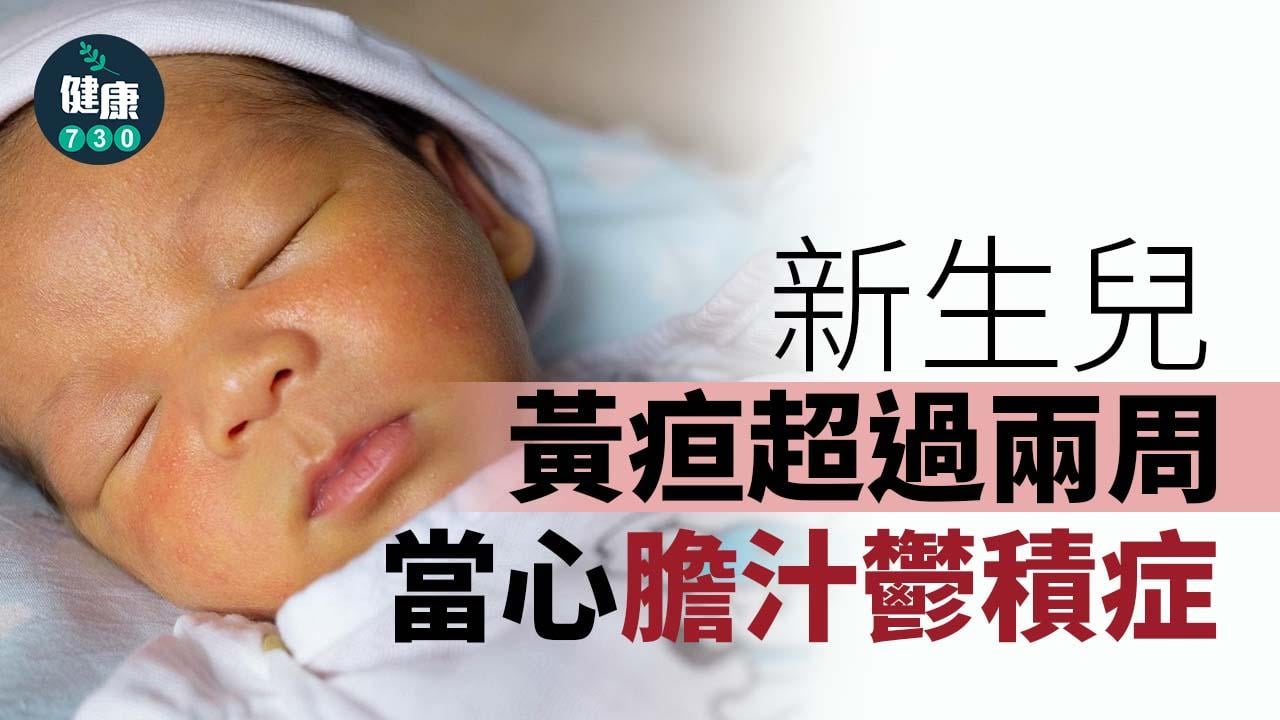 黃疸｜新生兒黃疸不消退 當心是膽汁鬱積症