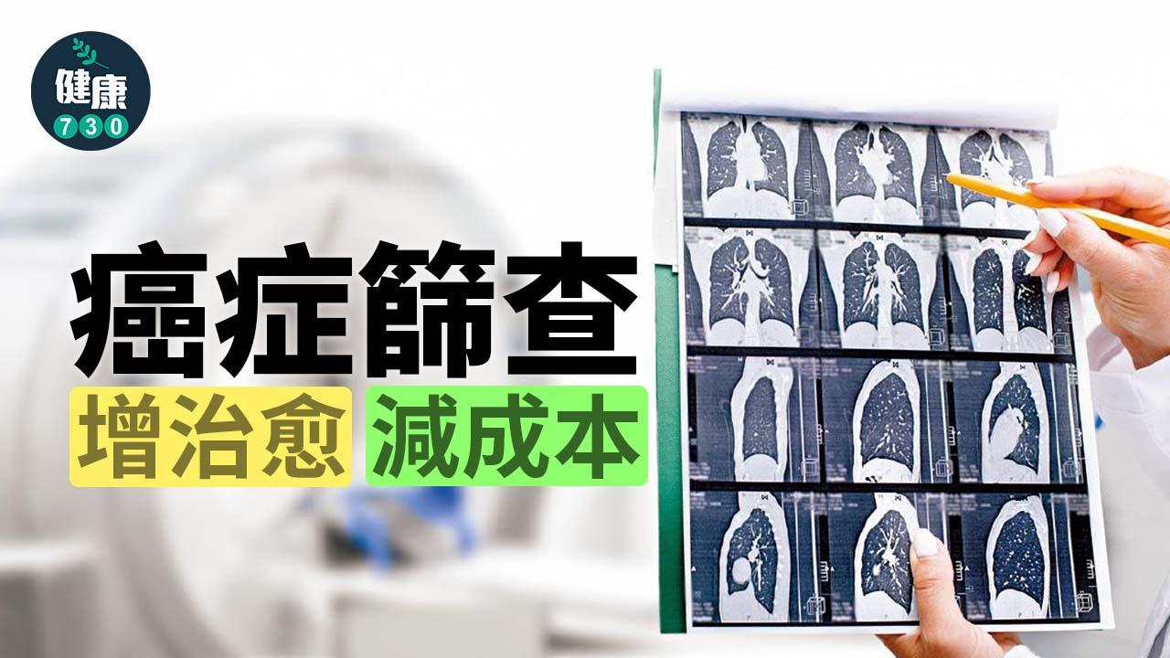 癌症篩查 增治愈 減成本