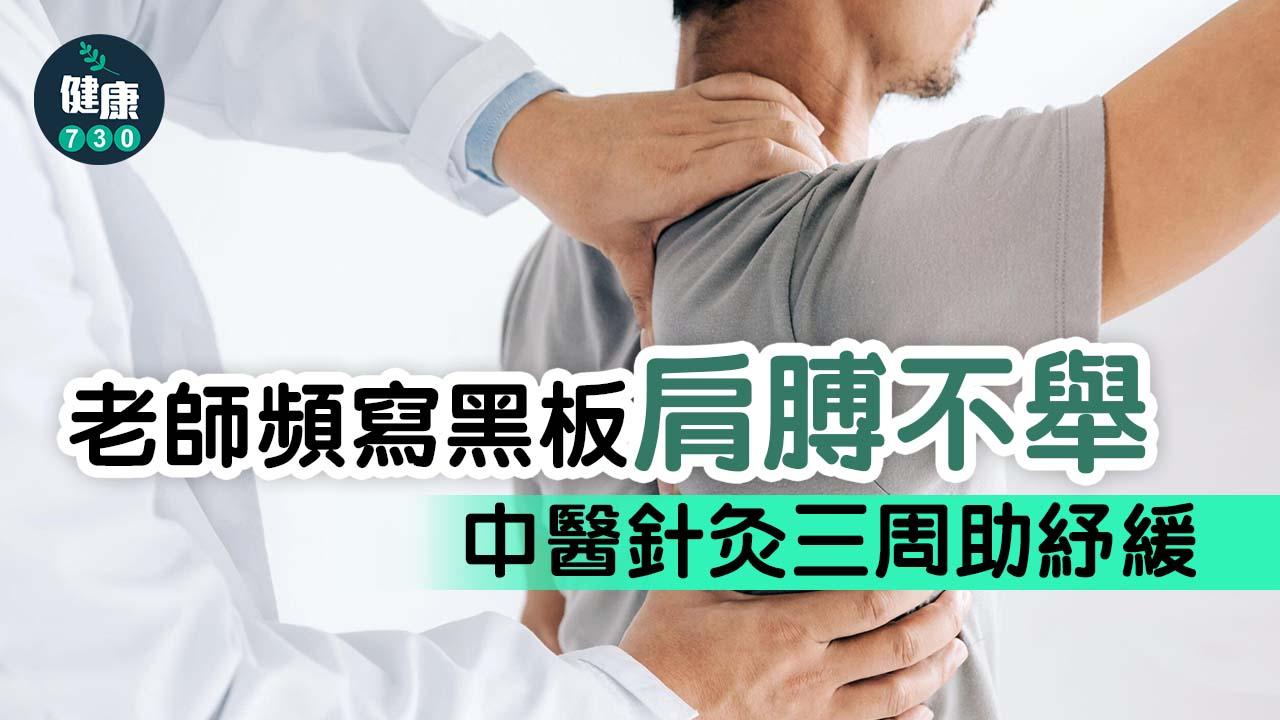 老師頻寫黑板肩膊不舉 中醫針灸三周助紓緩