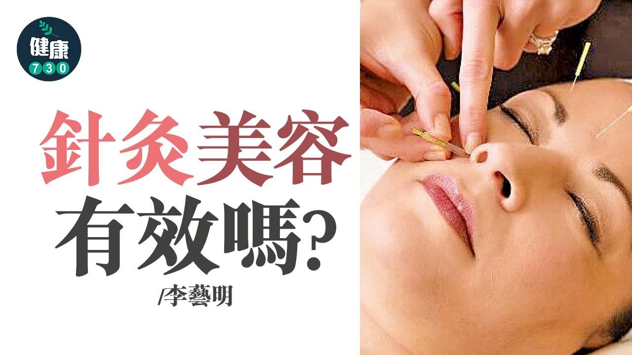 針灸美容 有效嗎？