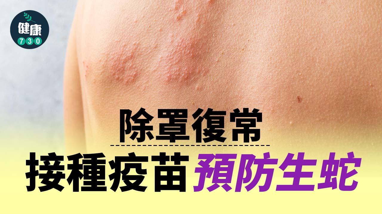 生蛇｜除罩復常 接種疫苗預防生蛇