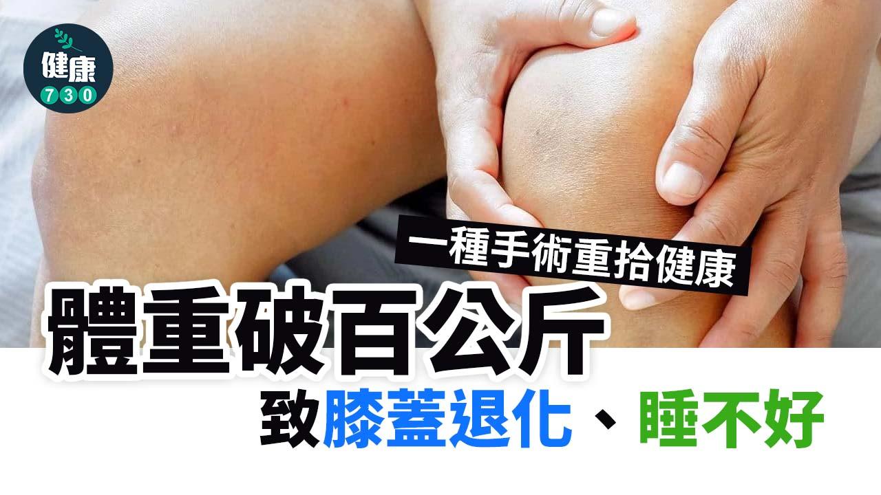 超重｜體重破百公斤致膝蓋退化、睡不好　一種手術重拾健康