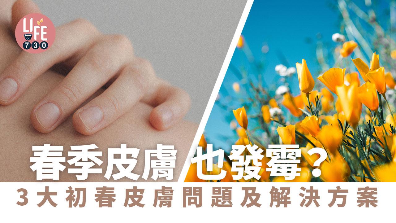 春季皮膚也發霉？3大初春皮膚問題及解決方案