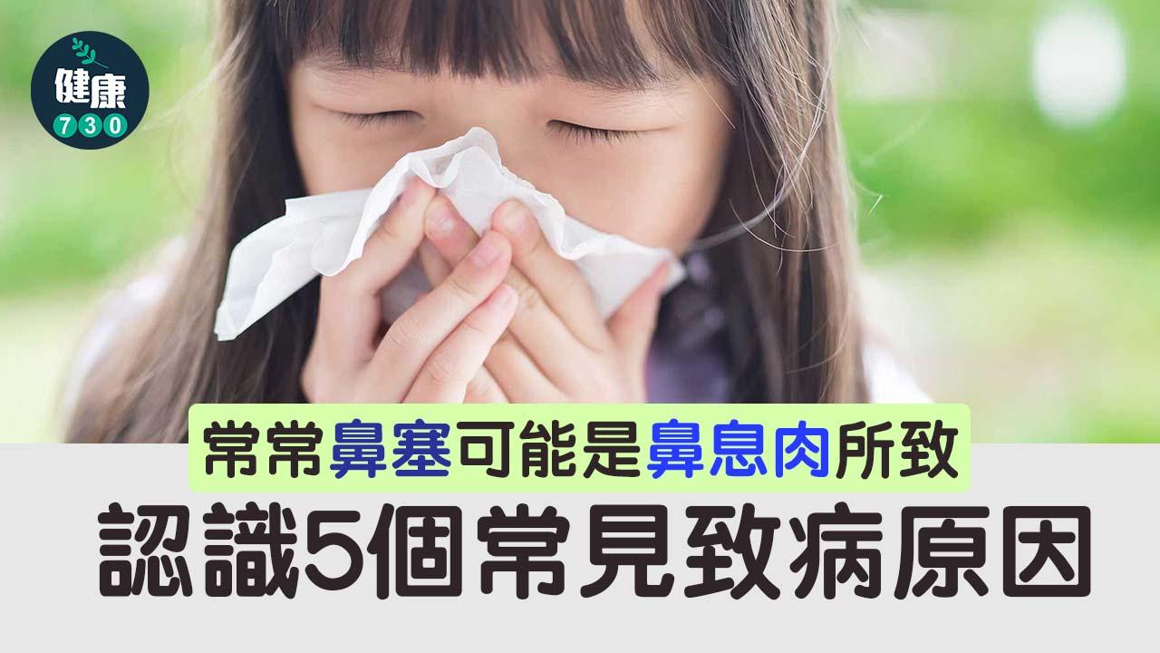 鼻塞｜常常鼻塞可能是鼻息肉所致 認識5個常見致病原因
