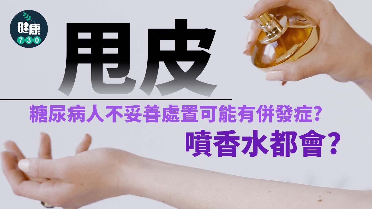 甩皮｜噴香水都會甩皮？糖尿病人不妥善處置可能有併發症？