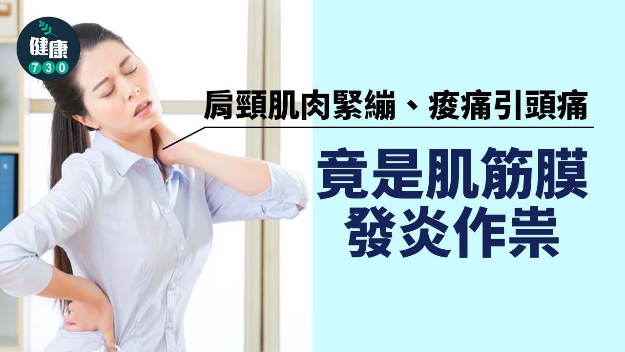肩頸肌肉緊繃、痠痛引頭痛 竟是肌筋膜發炎作祟