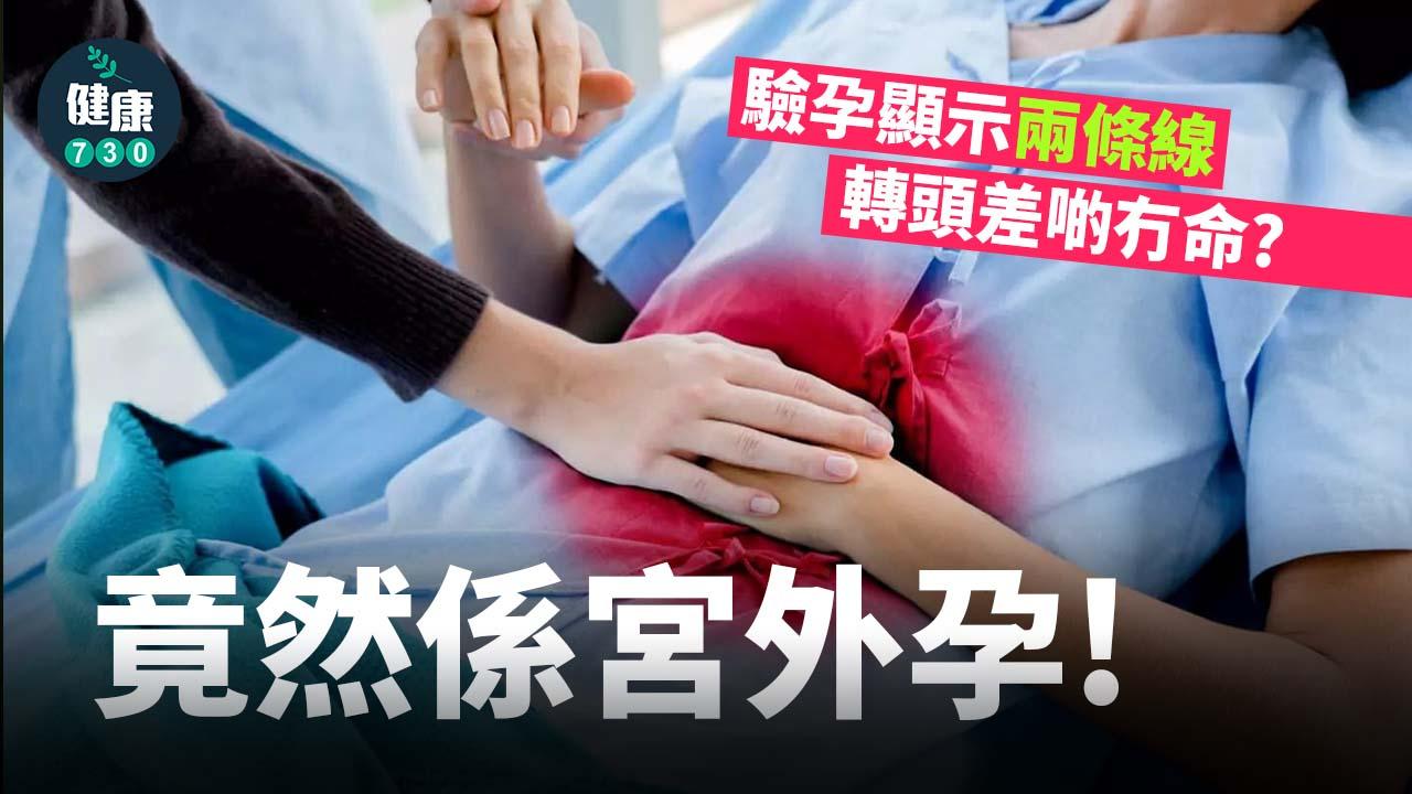 驗孕顯示兩條線！轉頭差啲冇命？竟然係宮外孕