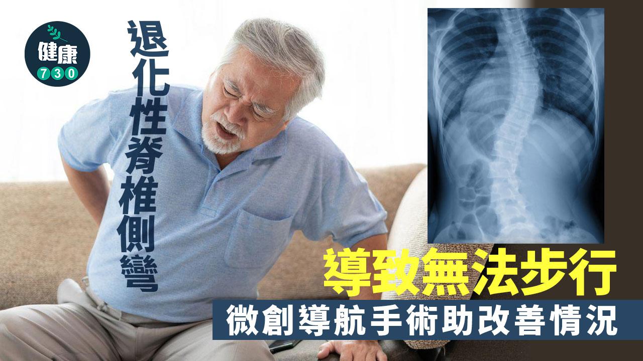 伯伯痛到行唔到 原來脊柱側彎？微創導航手術治療助行
