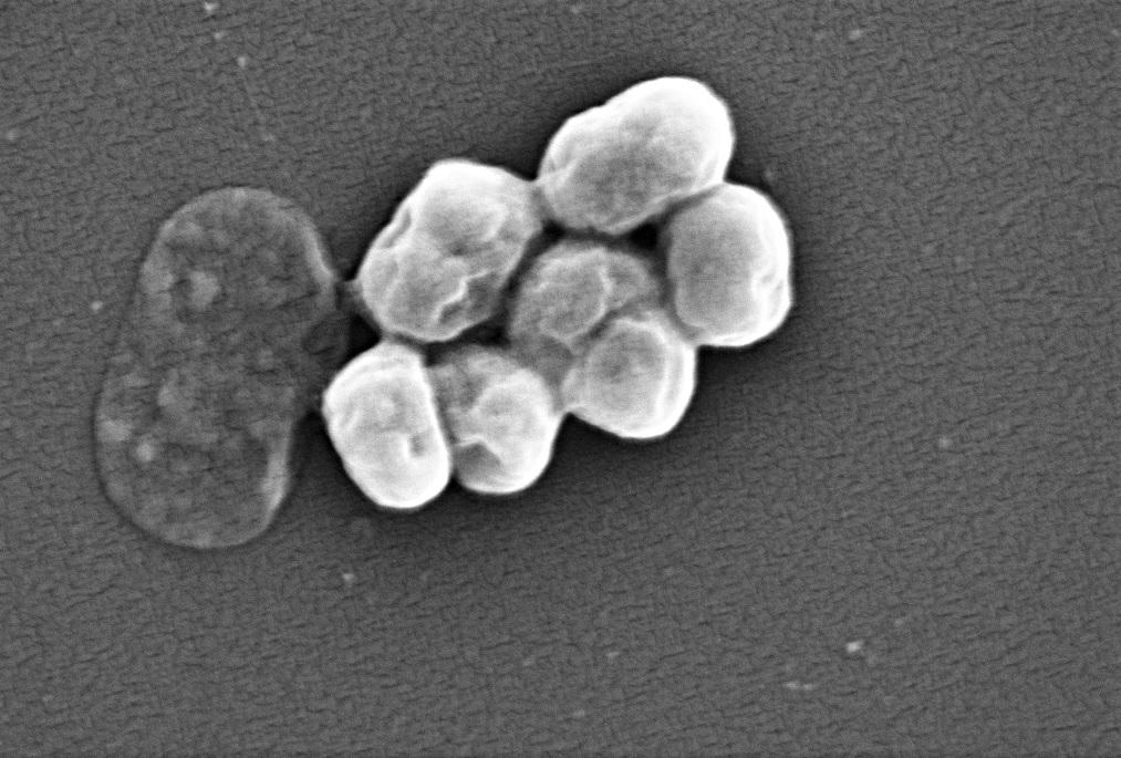 電子顯微鏡下的鮑氏不動桿菌。(互聯網)