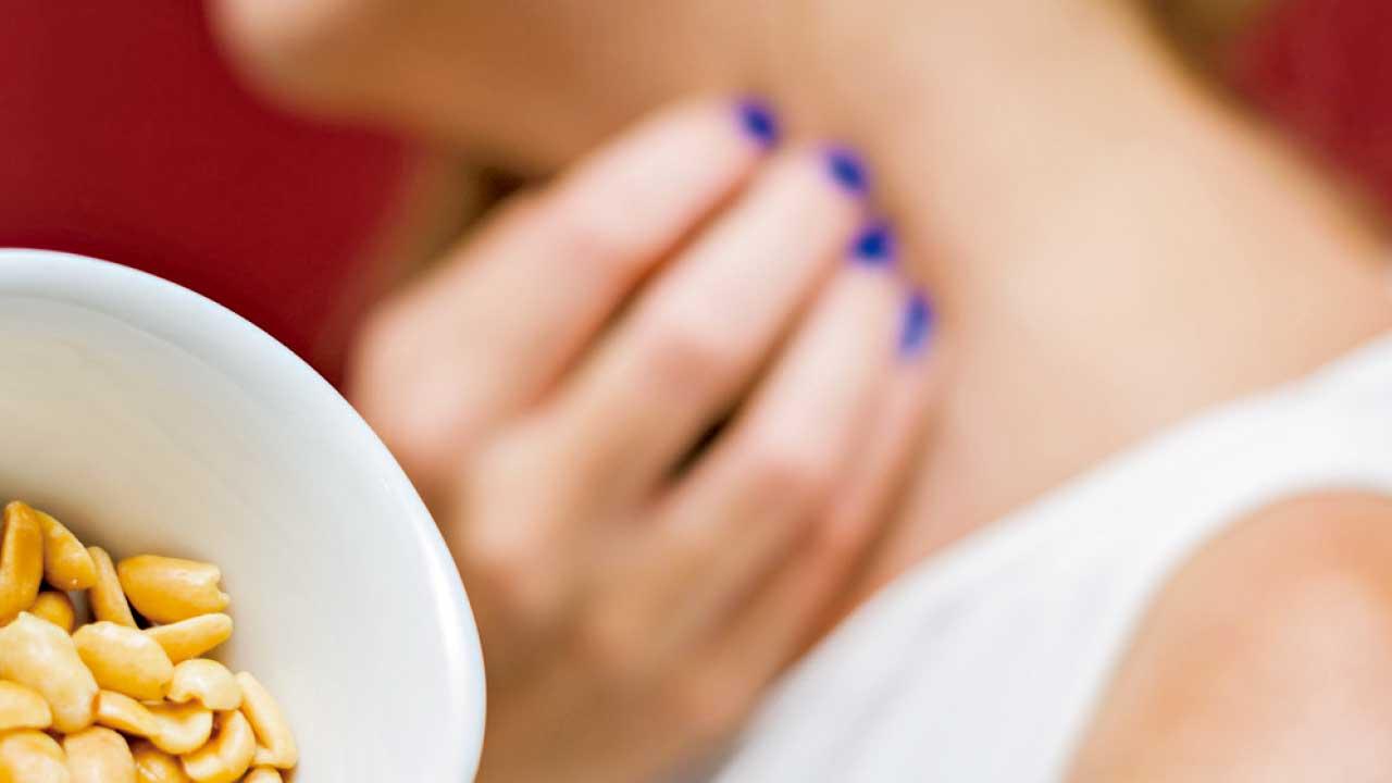 研究：亞洲人比白人 更容易食物過敏