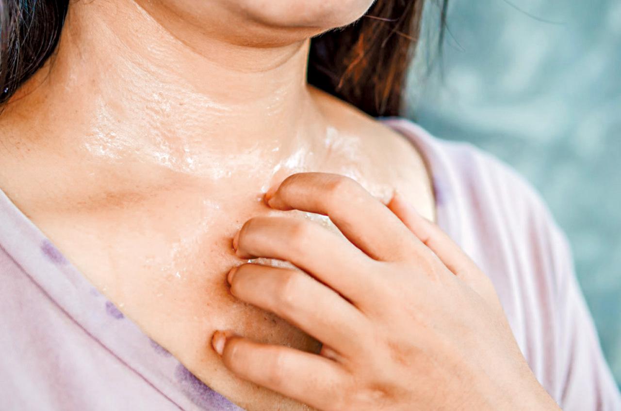 潮熱盜汗 代表更年期已到？