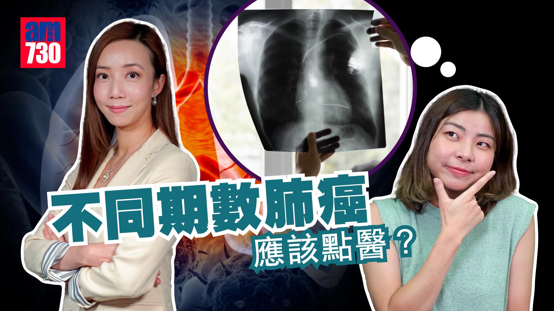 不同期數肺癌應該點醫？