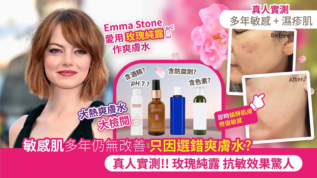 敏感肌多年仍無改善 只因選錯爽膚水？真人實測！玫瑰純露 抗敏效果驚人