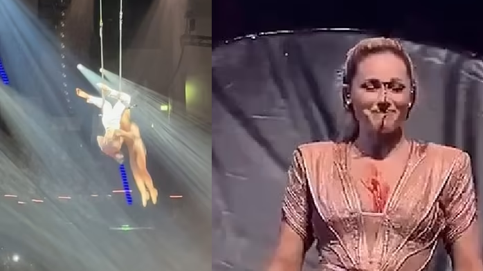 38歲女歌手演唱會表演空中飛人 割傷面部血流如注 歌名被指不吉利(有片)